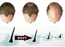 Saç Ekim İşlemine İlişkin Doktorunuza Danışma Sürecinde Sizi Neler Bekliyor