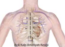 Kalp Hastalıkları ve Kardiyomiyopati