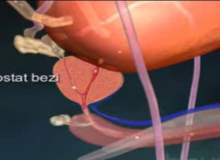 Benign Prostat Hiperplazisi (Prostatta İyi Huylu Büyüme)