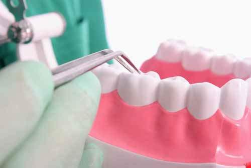 İmplantlar her diş eksikliğinde kullanılabilir mi? Hemen Sağlık
