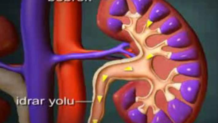 İdrara Çıkamama Tedavisi