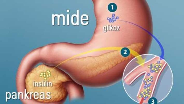 Gastritin Nedenleri Nelerdir?